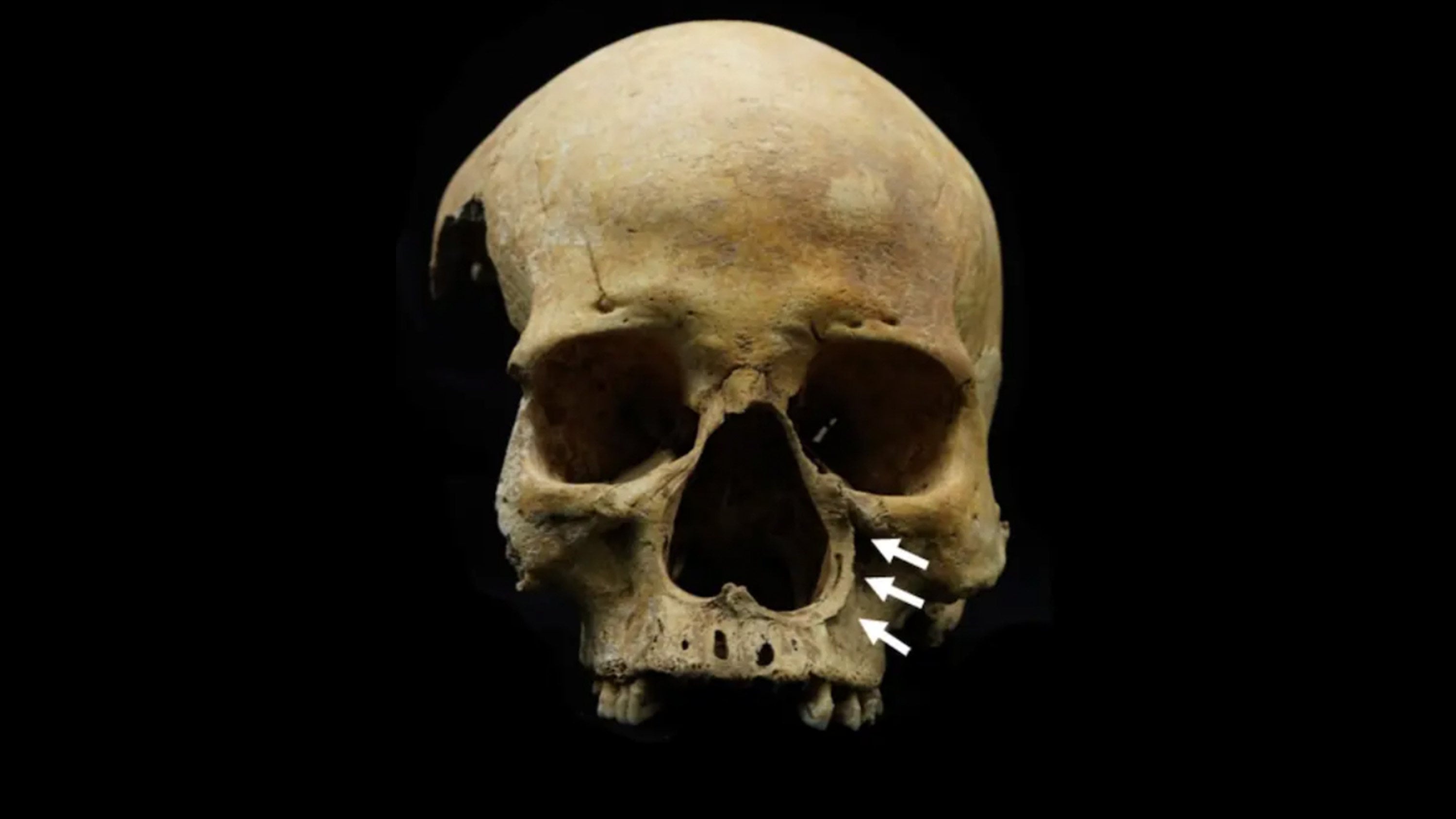Cientistas chineses encontram as primeiras evidências da antiga punição de corte do nariz para ladrões de gado