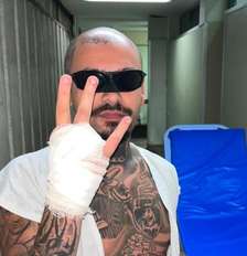 Streamer teve dedo amputado ao pular a grade do Rock in Rio. Foto: Reprodução/Instagram @lodk7777