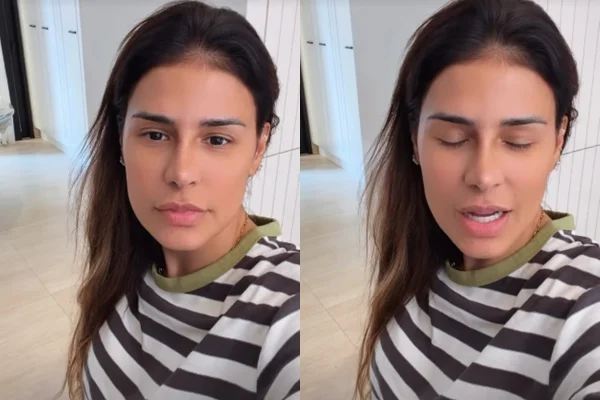 Simone Mendes mostra resultado de procedimento estético no nariz. Veja - destaque galeria