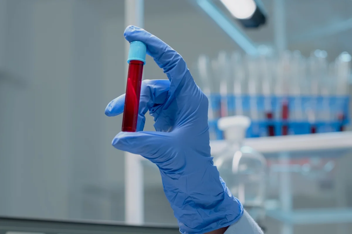 Novo exame de sangue que detecta mais de 50 tipos de câncer chega ao Brasil