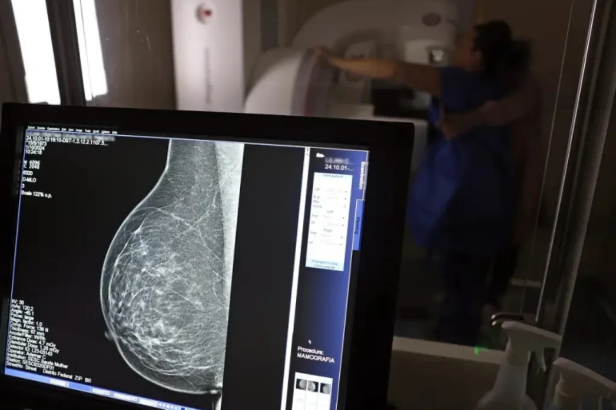 mulher fazendo mamografia