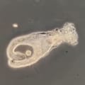 Así actúa el naegleria fowleri, el extraño microorganismo que contrajo el niño fallecido en Catamarca