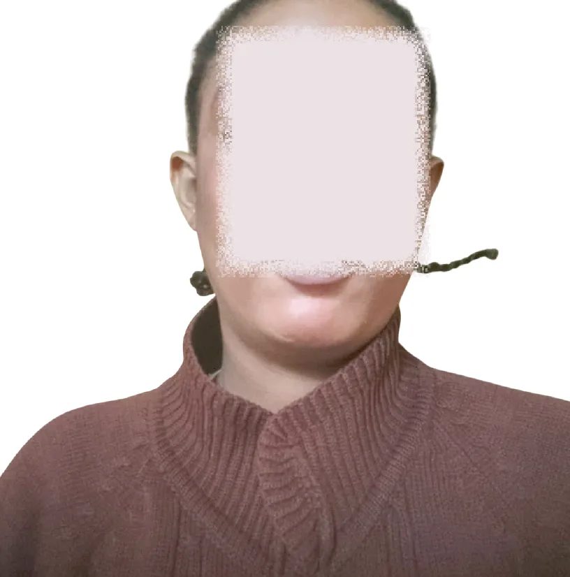 Help! I have no vaginal opening for sex – Graduate seeking surgery