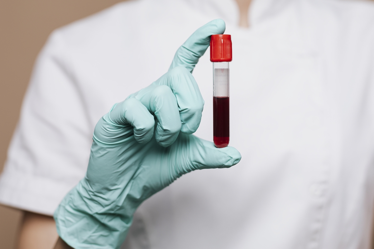 Cardiologista explicas reais impactos da testosterona para o coração